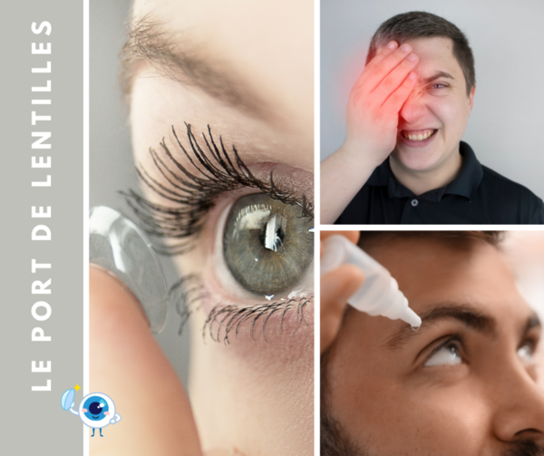 Lentilles de contact l’inconfort n’est pas banal